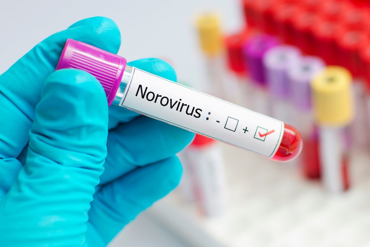 Norovirusas – vienas nemaloniausių ir įkyriausių patogenų 