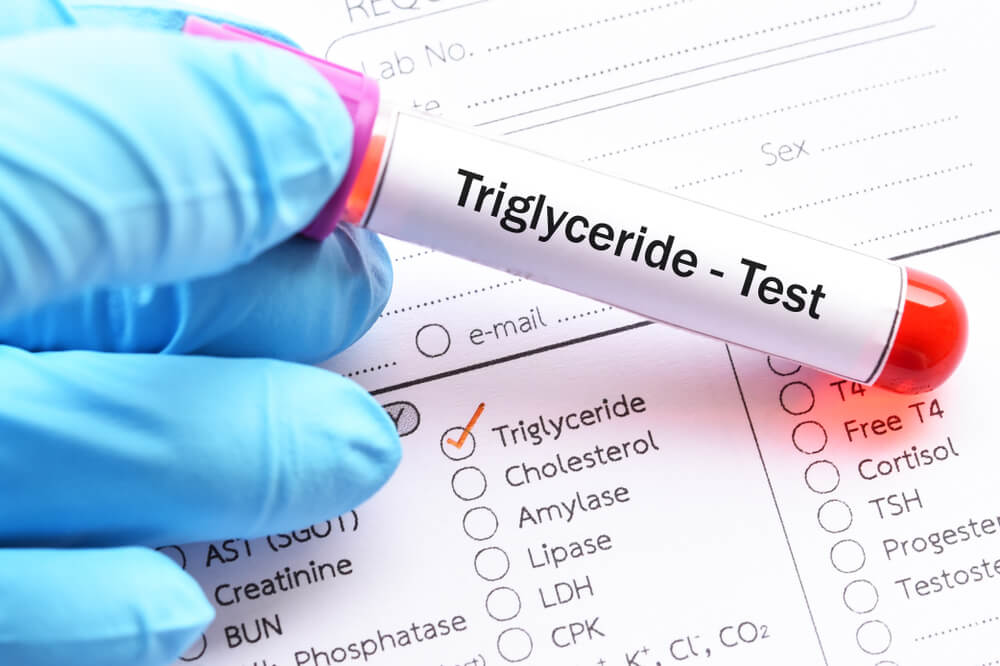 Trigliceridai organizmui gyvybiškai būtini, bet perteklius gali pakenkti