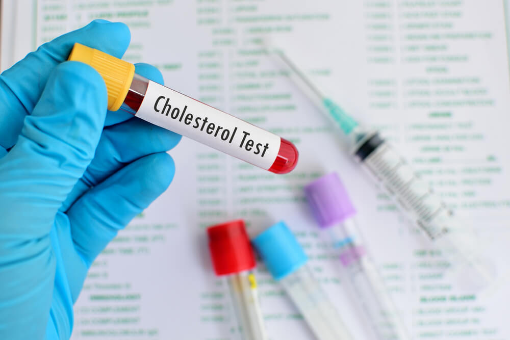 Cholesterolio savikontrolė gali išgelbėti ir gyvybę