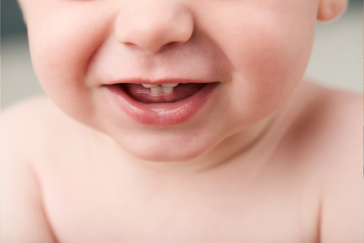 Vaikučiui dygsta dantys: skausmą ir diskomfortą įmanoma sumažinti