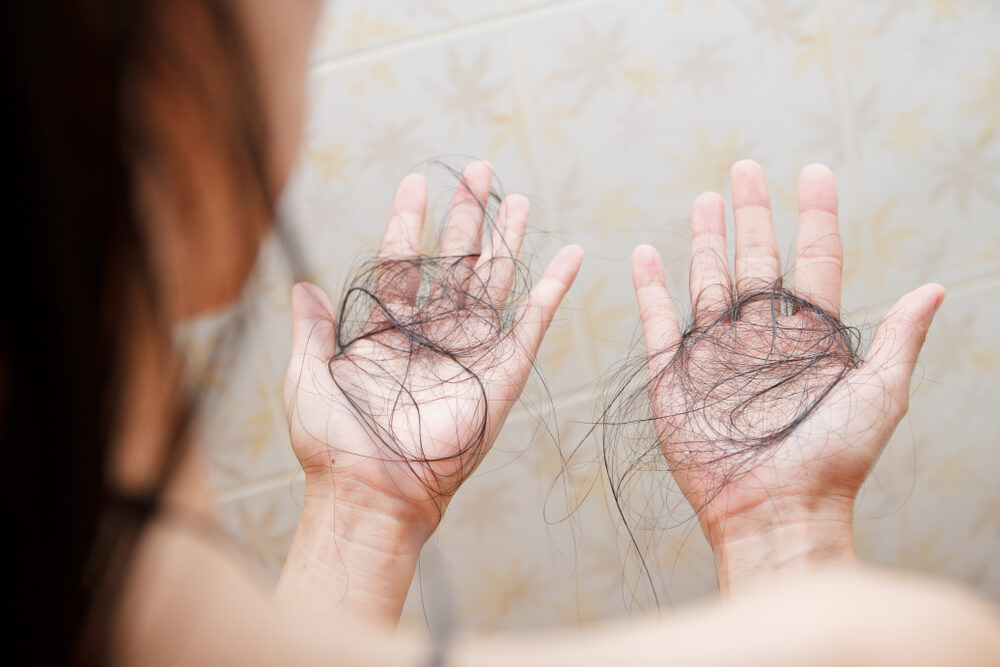 Plaukų slinkimas | Mano Vaistinė